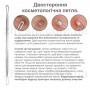 Набор инструментов для чистки кожи лица - удаление акне, угрей - алюминиевый футляр - 5 инструментов