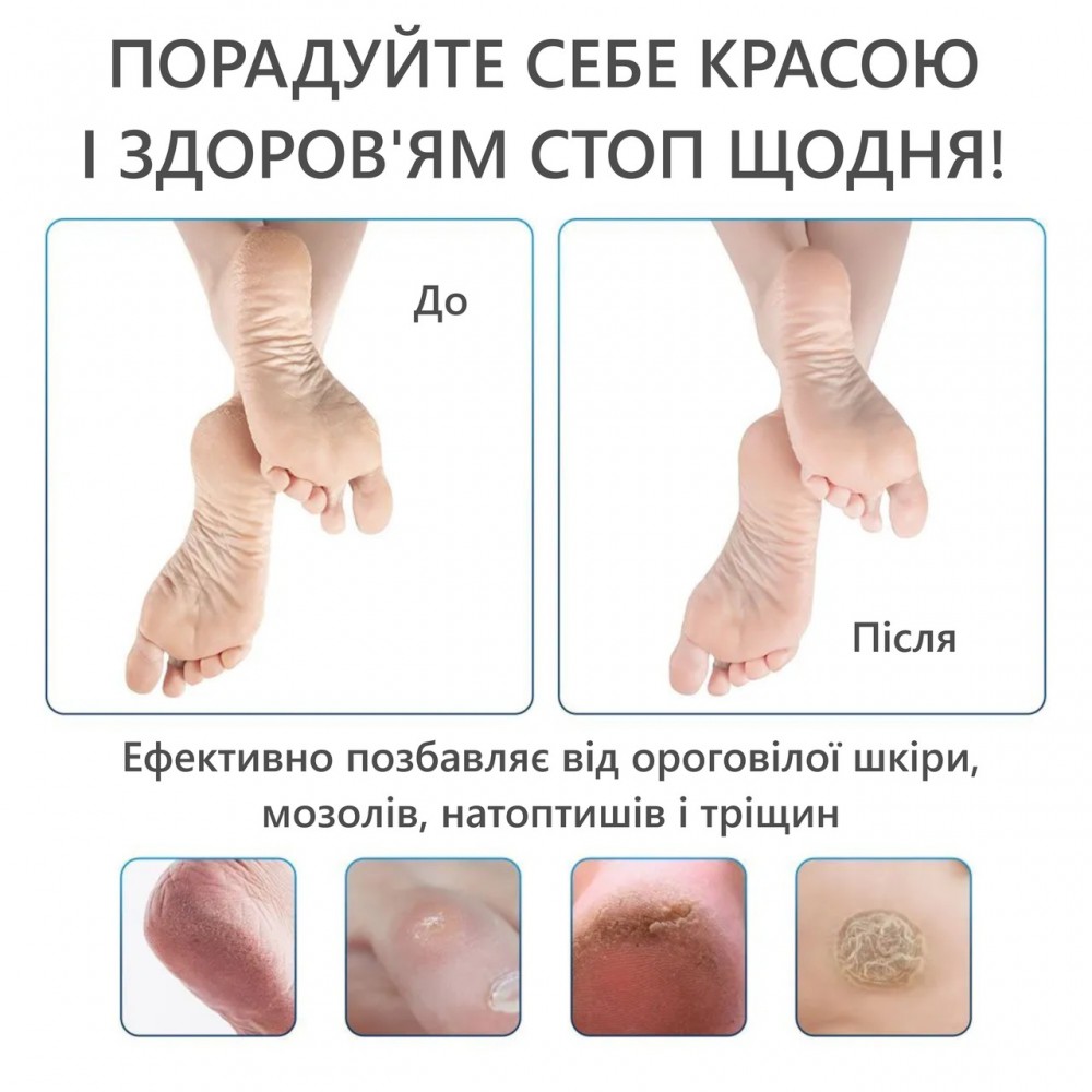 Набор инструментов для ухода за ногами 10 в 1 - набор для педикюра в кейсе - blue